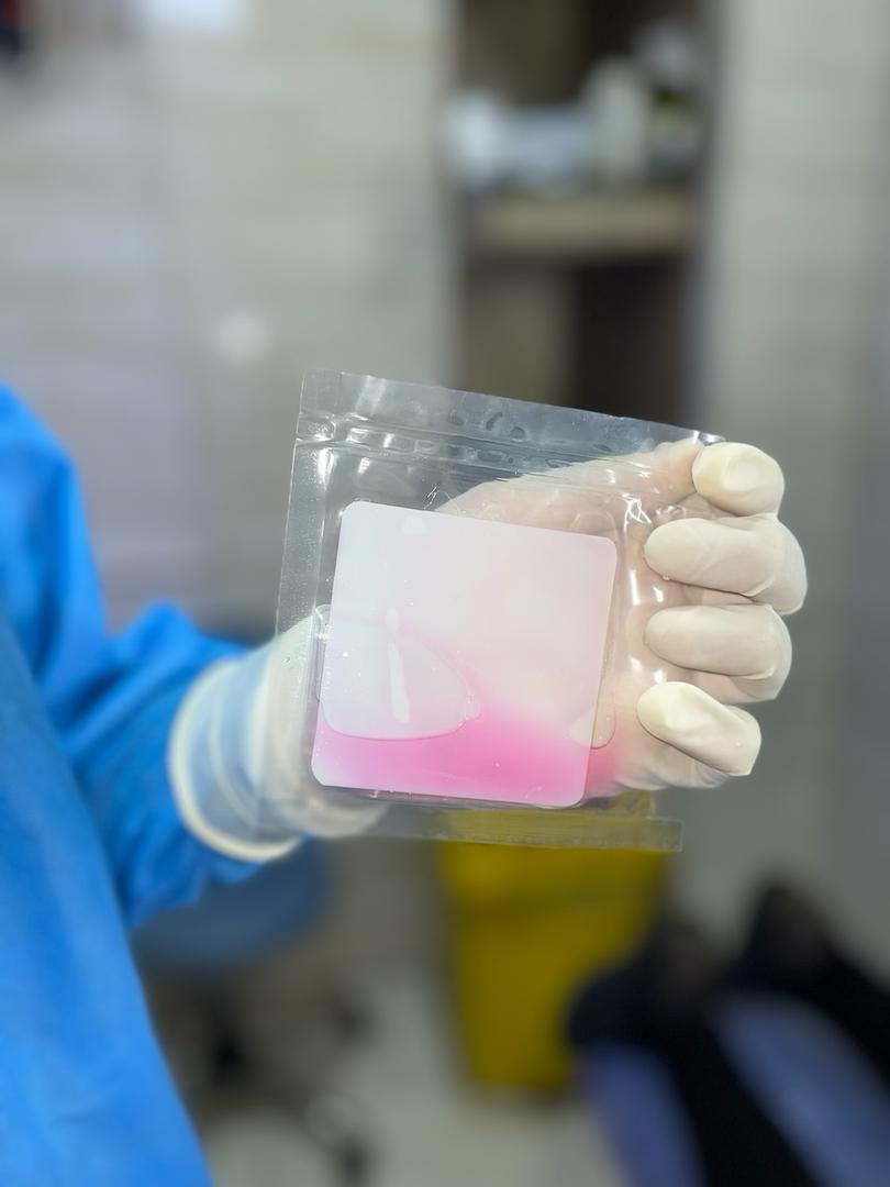 کلینیک زخم نیلمهر | درمان زخم بستر و زخم پای دیابتی در شهریار، اندیشه و فردیس 9 پرده آمونیوتیک